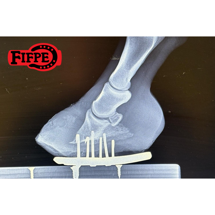 SAGITTAL PUNTA QUADRA E CIPOLLE ANTERIORE NO CLIPS